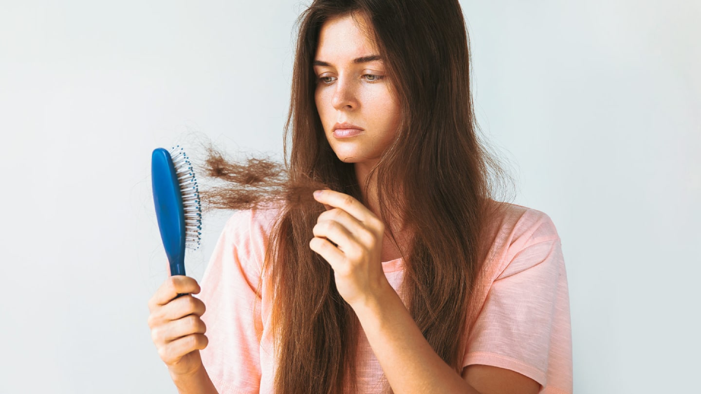 Eine Frau hält eine Bürste in der Hand, der aufgrund von Haarausfall Haare ausgerissen wurden.